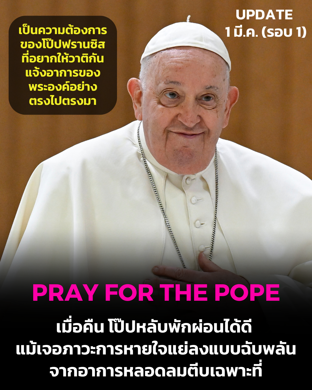 UPDATE: โป๊ปหลับพักผ่อนได้ดี แม้เจอภาวะการหายใจแย่ลงแบบฉับพลัน จากอาการหลอดลมตีบเฉพาะที่