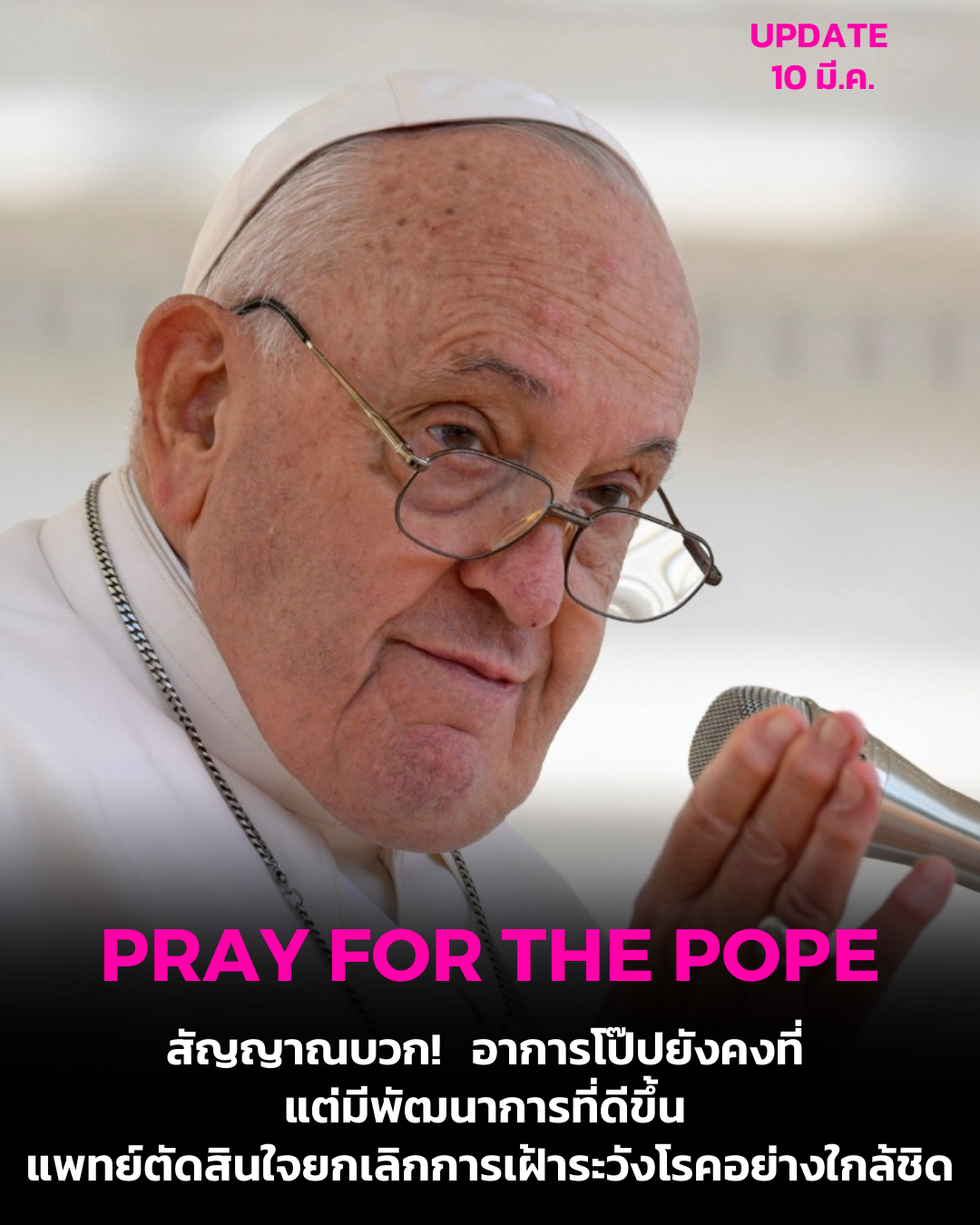 UPDATE: สัญญาณบวก! อาการโป๊ปยังคงที่ แต่มีพัฒนาการที่ดีขึ้น แพทย์ตัดสินใจยกเลิกการเฝ้าระวังโรคอย่างใกล้ชิด