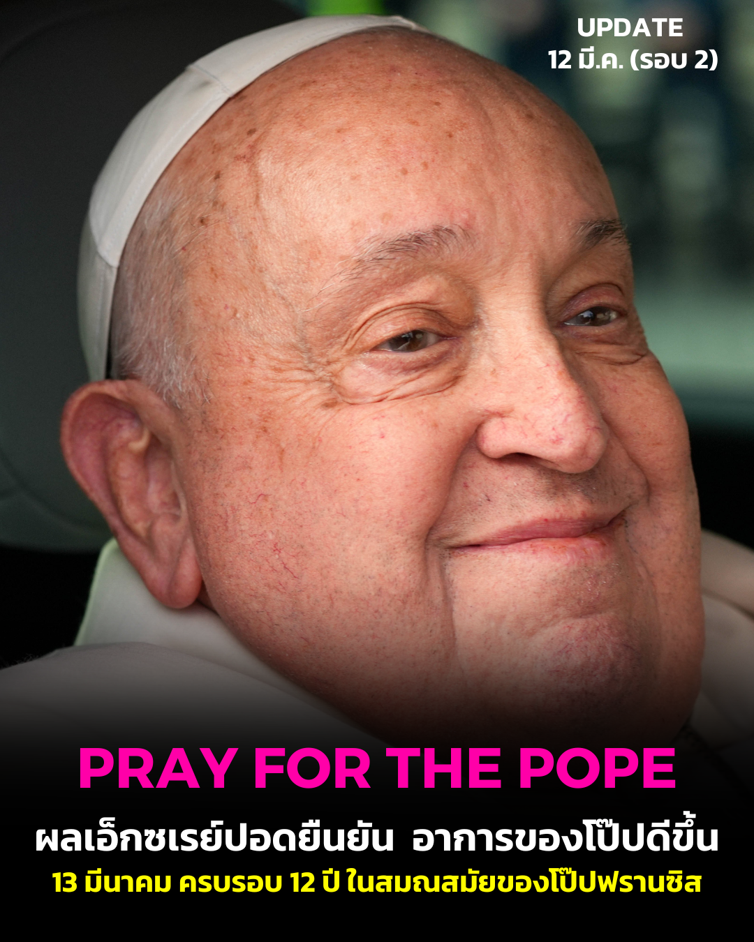 UPDATE: ผลเอ็กซเรย์ปอดยืนยัน อาการของโป๊ปดีขึ้น